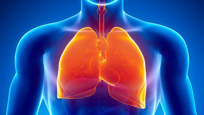 Akciğer ve Solunum Yolları Hastalıklarının Evde Doğal Tedavi Yöntemleri Nelerdir? 1